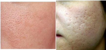 Lees meer over het artikel Glad, gladder, gladst